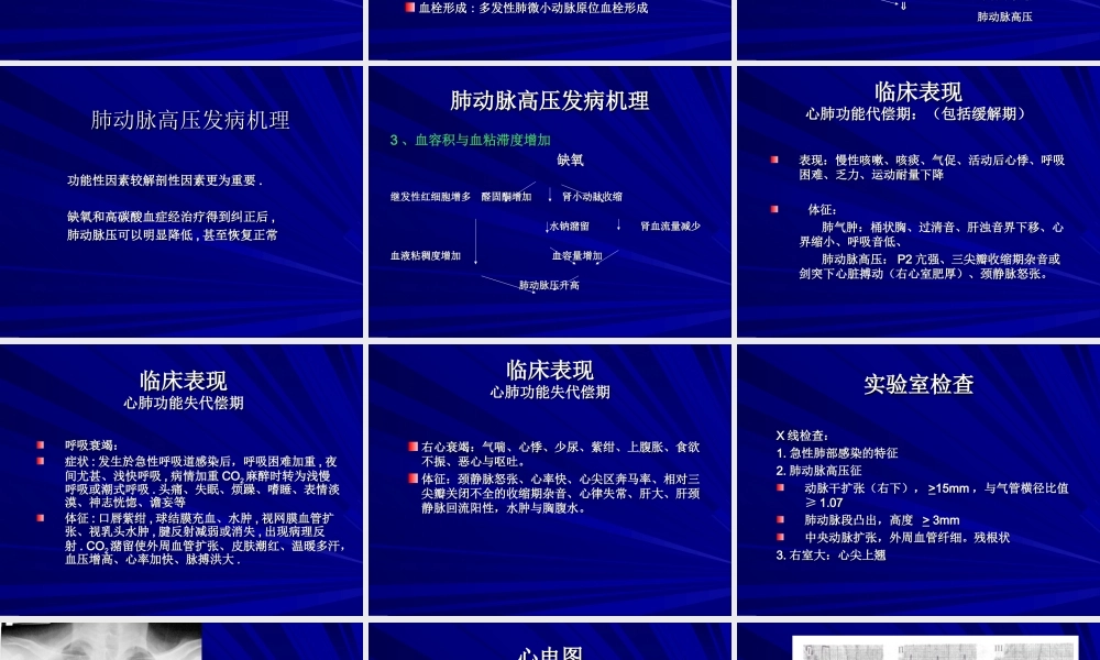 慢性肺源性肺心病.ppt