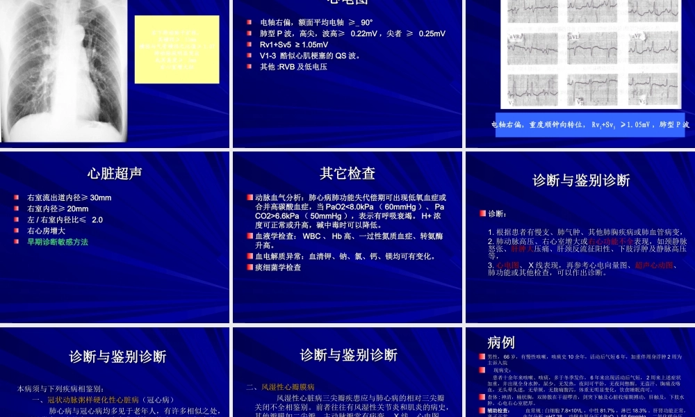 慢性肺源性肺心病.ppt
