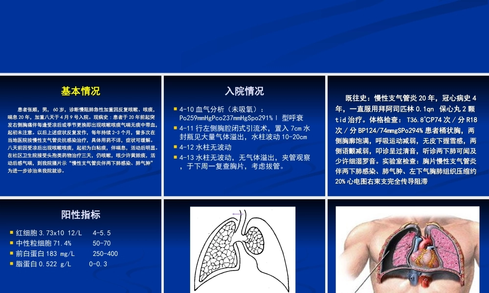 慢阻肺合并自发性气胸汇编.ppt