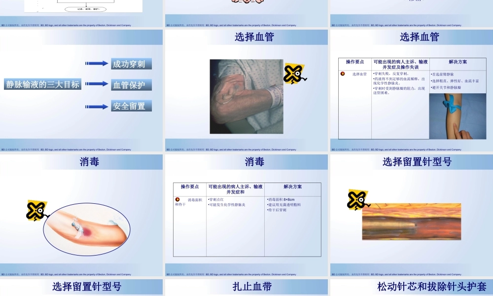 成功在你手中(规范使用静脉留置针).ppt