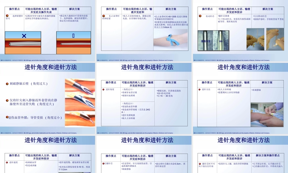 成功在你手中(规范使用静脉留置针).ppt