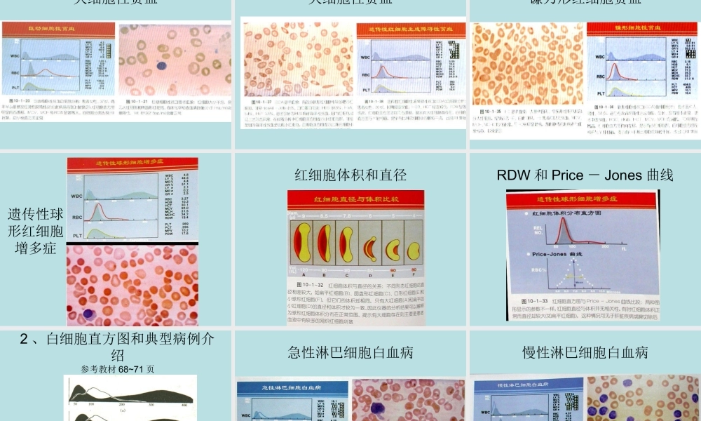 成教-血细胞分析仪直方图特点.ppt