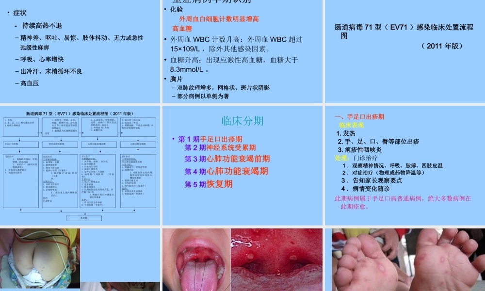 手足口病..ppt