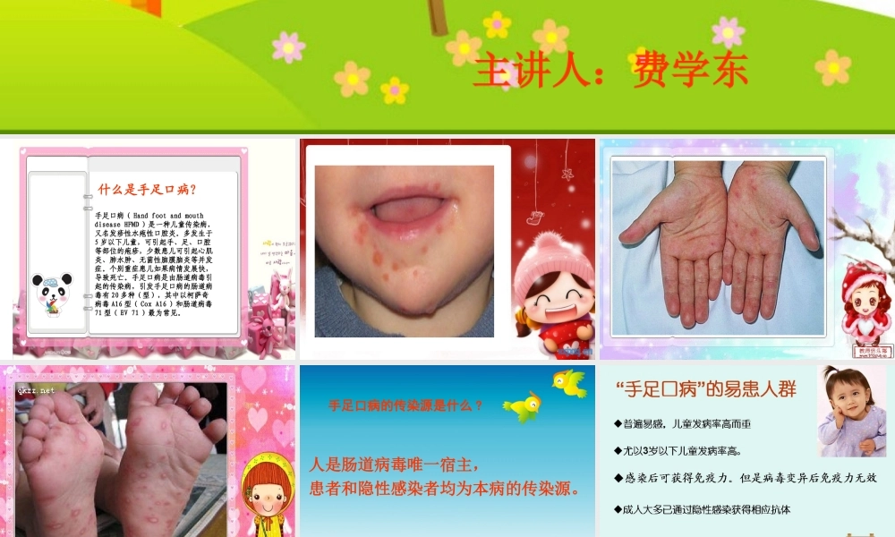 手足口病PPT幼儿版.ppt