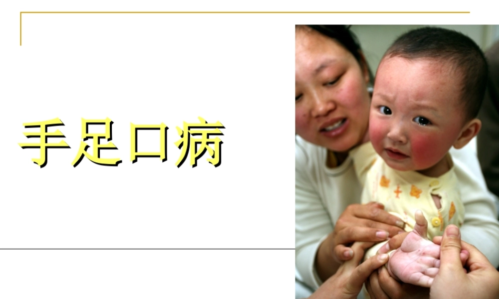手足口病知识分析.ppt