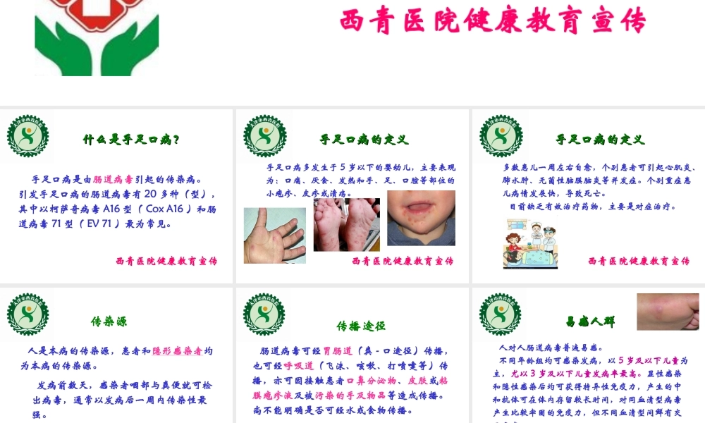 手足口病防治2014.ppt