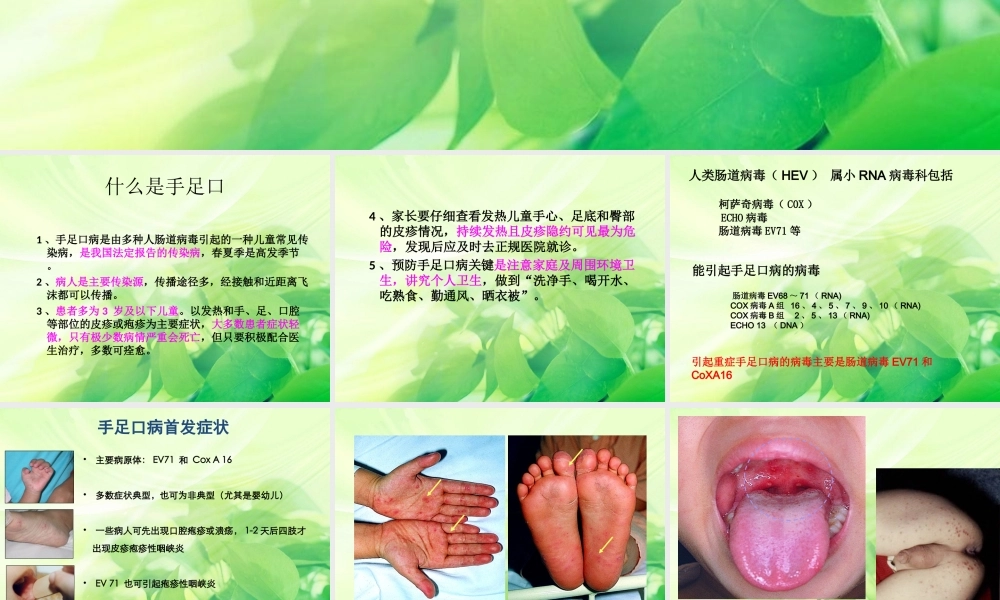 手足口病防治要点2014.4.ppt