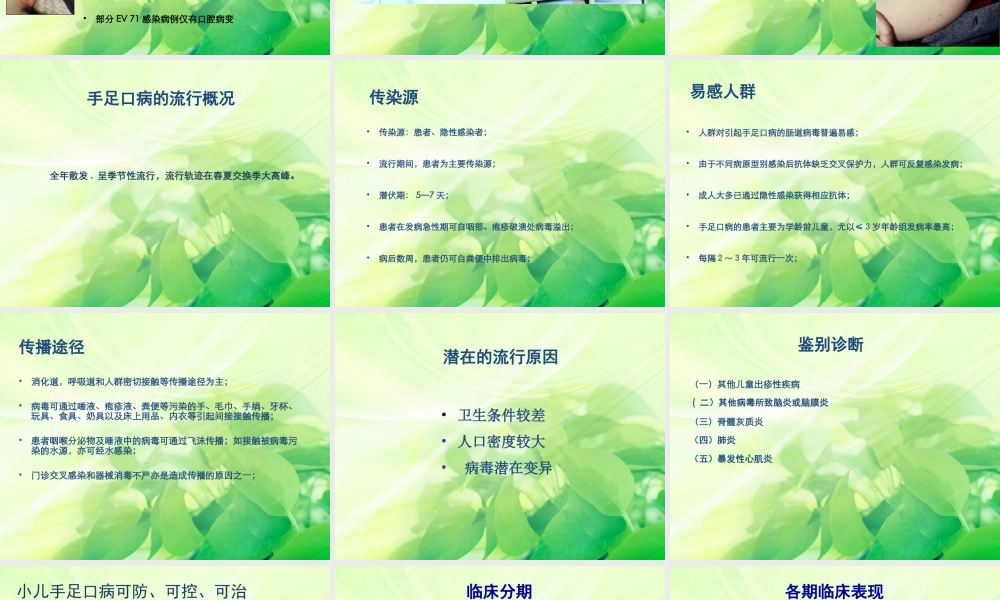 手足口病防治要点2014.4.ppt