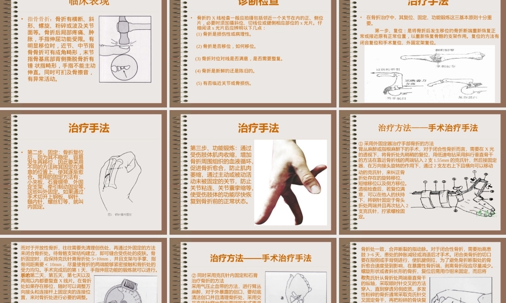手骨骨折ppt1.ppt