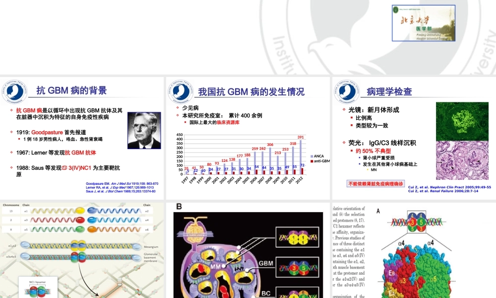 抗GBM病的进展.pptx