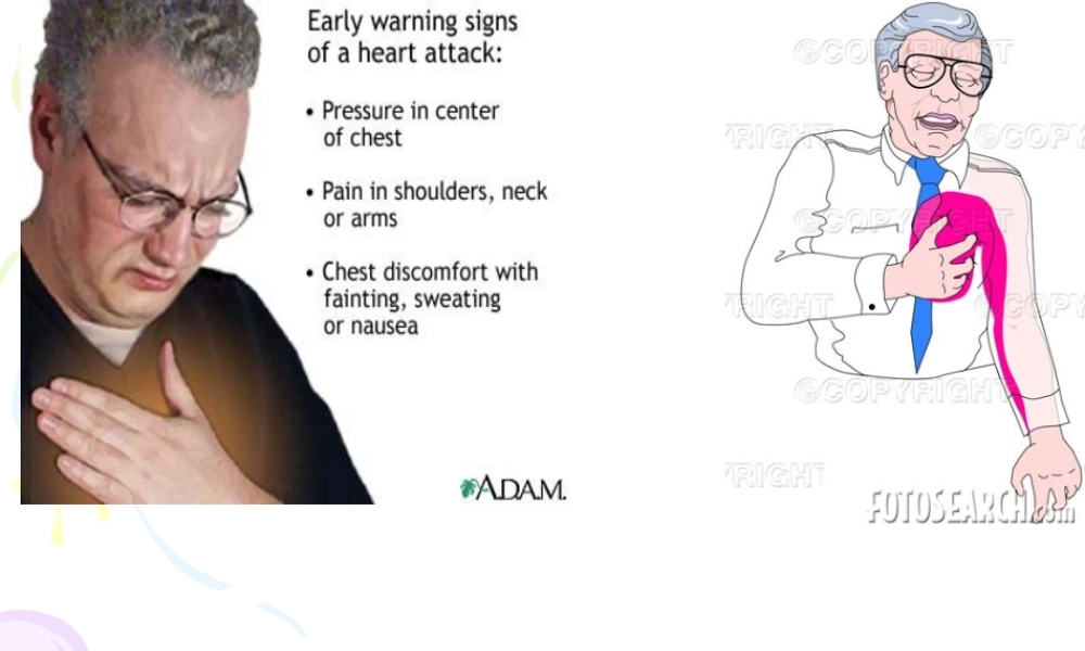 抗心绞痛药-31.ppt