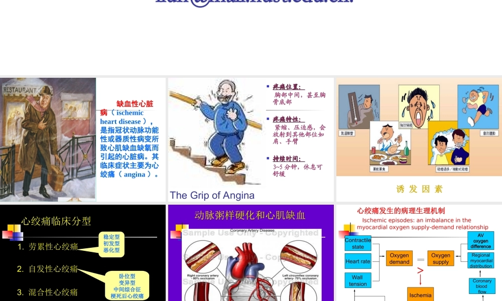 抗心肌缺血药-五年制.ppt