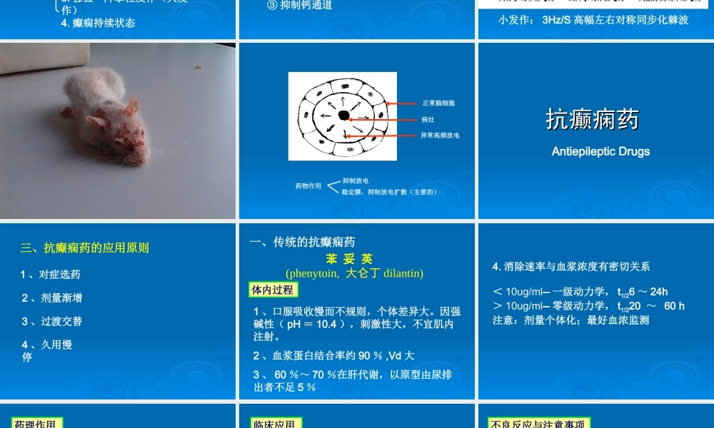 抗惊厥和抗癫痫药.ppt