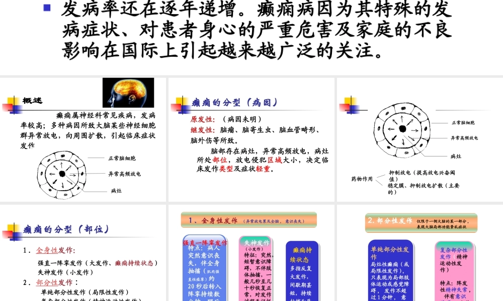 抗癫痫及抗惊厥药.ppt