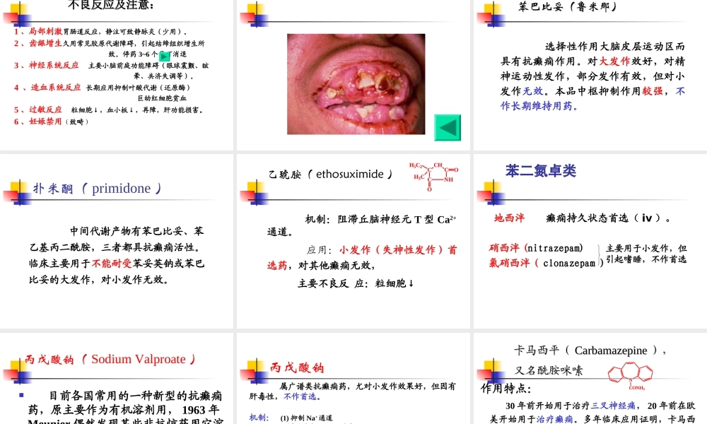 抗癫痫及抗惊厥药.ppt