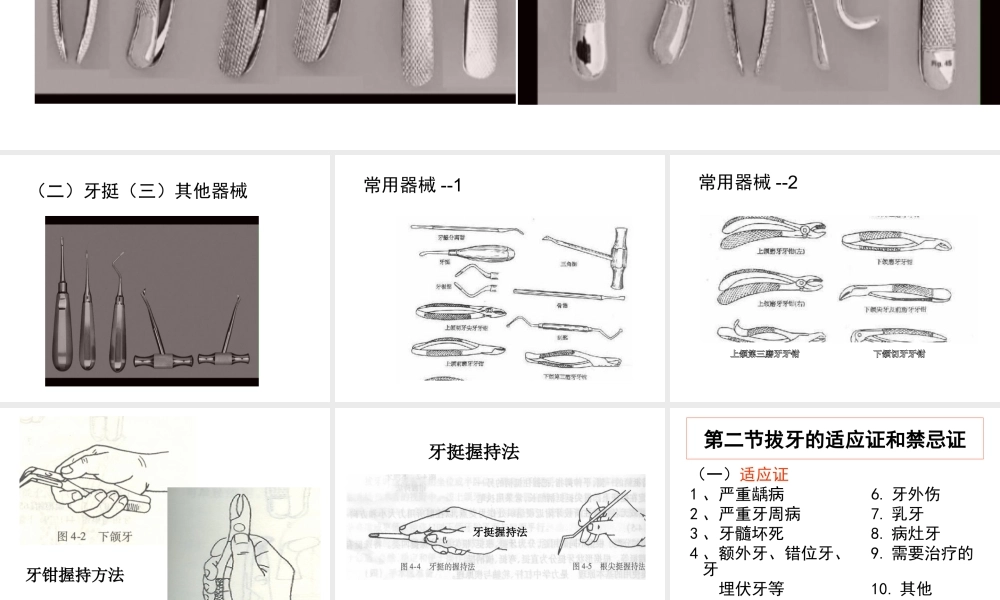 拔牙的过程如何.ppt