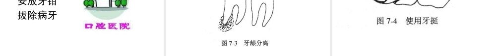 拔牙的过程如何.ppt