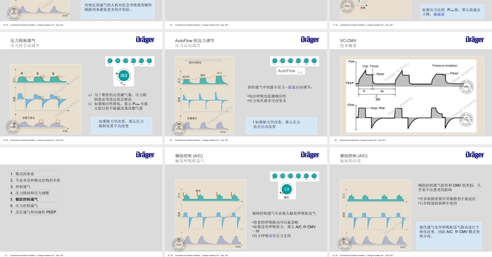 控制通气与辅组通气的模式与术语-王勇强.ppt