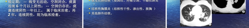 支扩、肺结核、肺癌.ppt