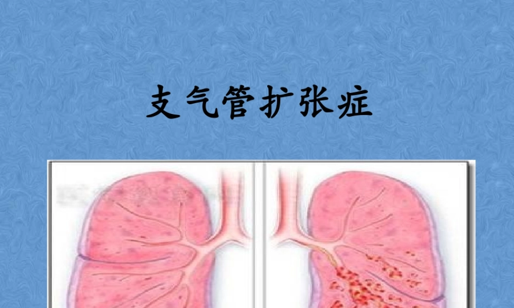 支气管扩张2018.ppt
