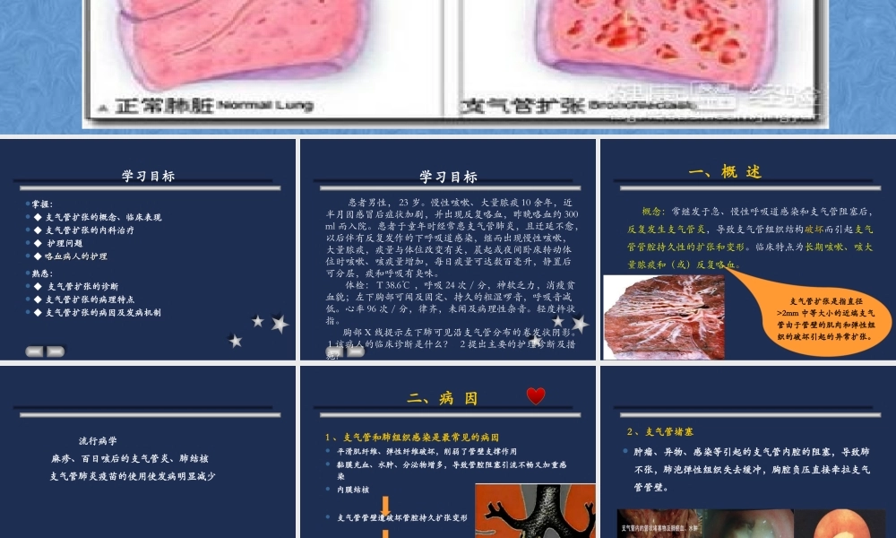 支气管扩张2018.ppt