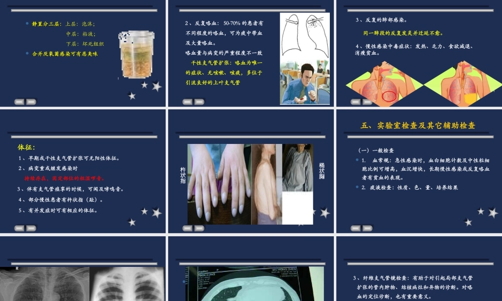 支气管扩张2018.ppt