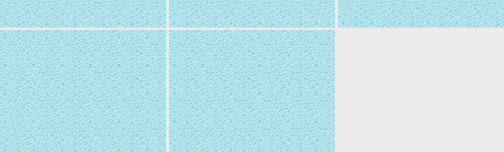 支气管扩张病人汇总.ppt