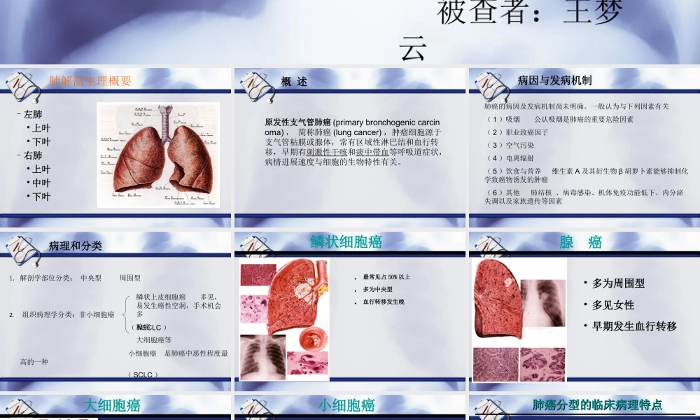 教学查房(肺癌).ppt