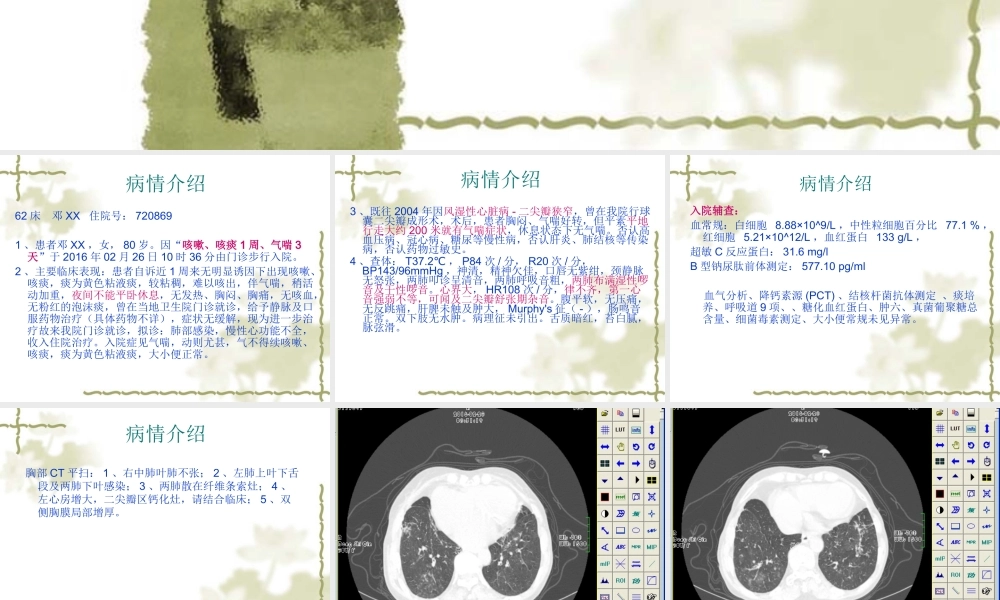 教学查房(二尖瓣狭窄2016.3.3).ppt