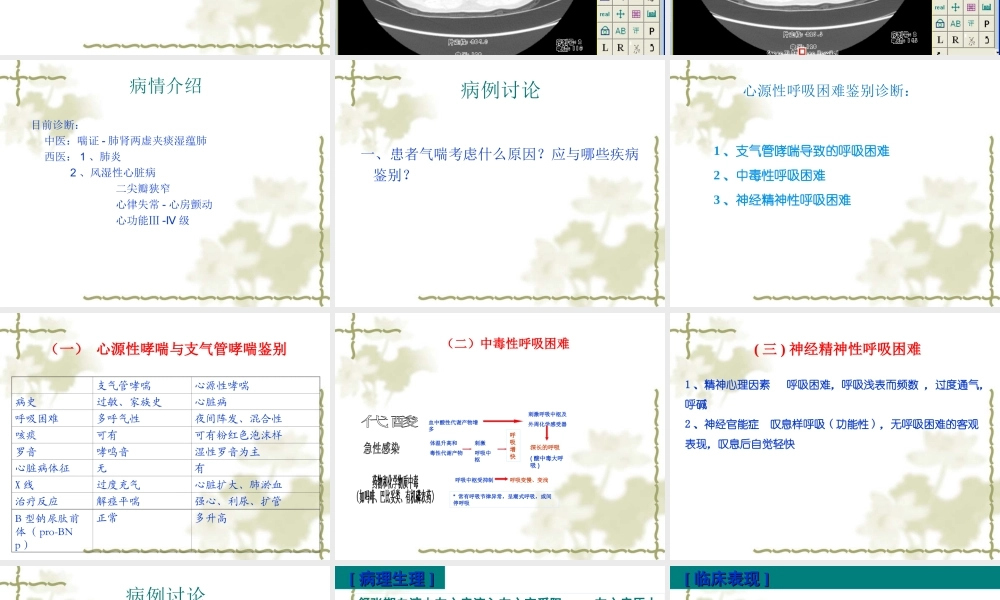 教学查房(二尖瓣狭窄2016.3.3).ppt