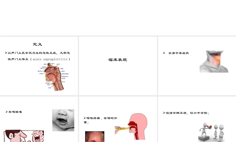 教学查房---急性会厌炎.ppt