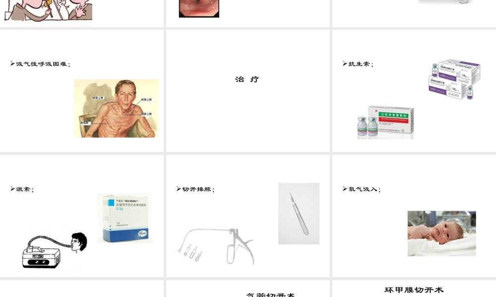 教学查房---急性会厌炎.ppt