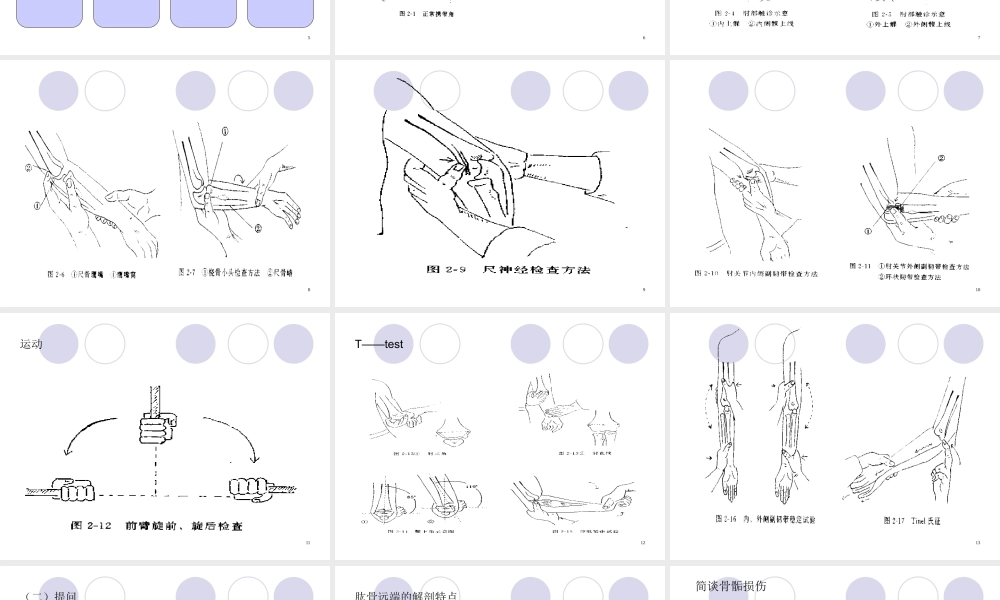 教学查房-儿童多发骨折归纳.ppt