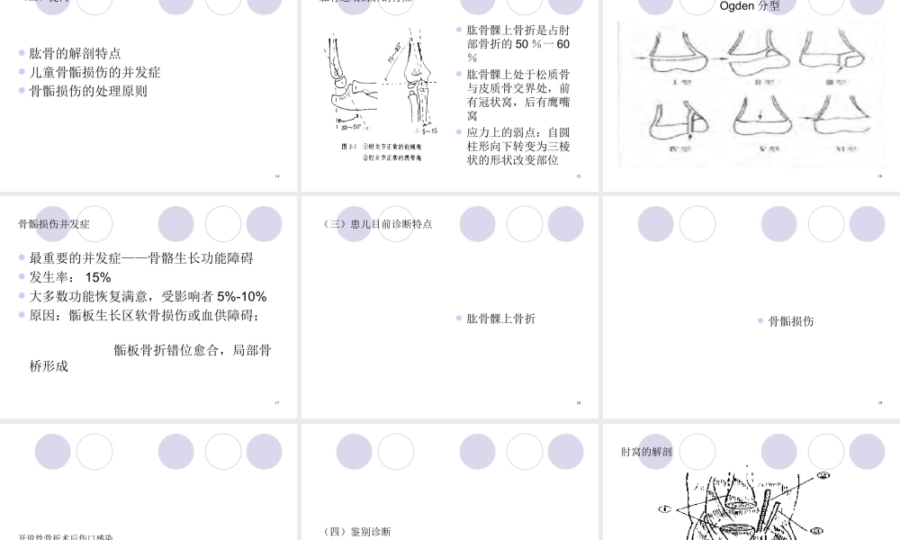 教学查房-儿童多发骨折归纳.ppt