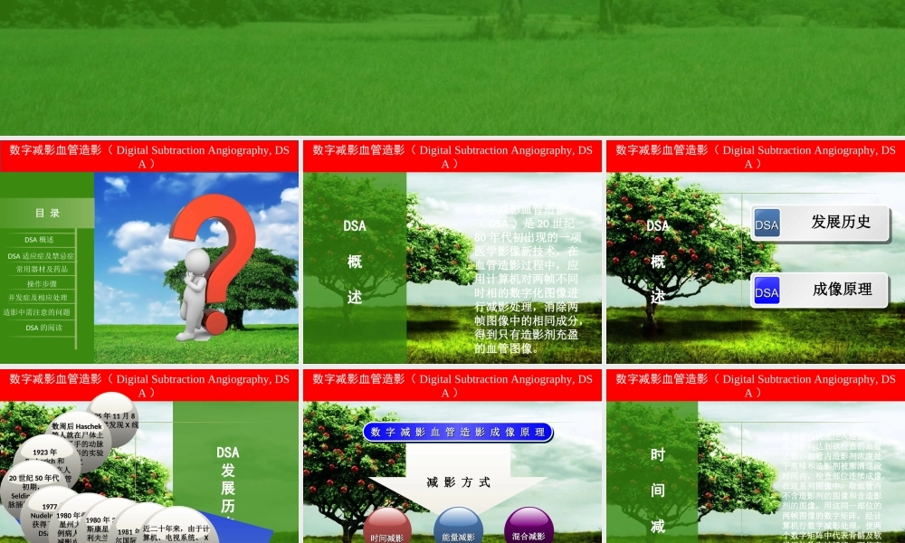 数字减影血管造影.ppt