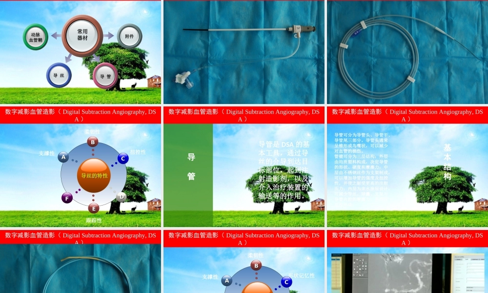 数字减影血管造影.ppt