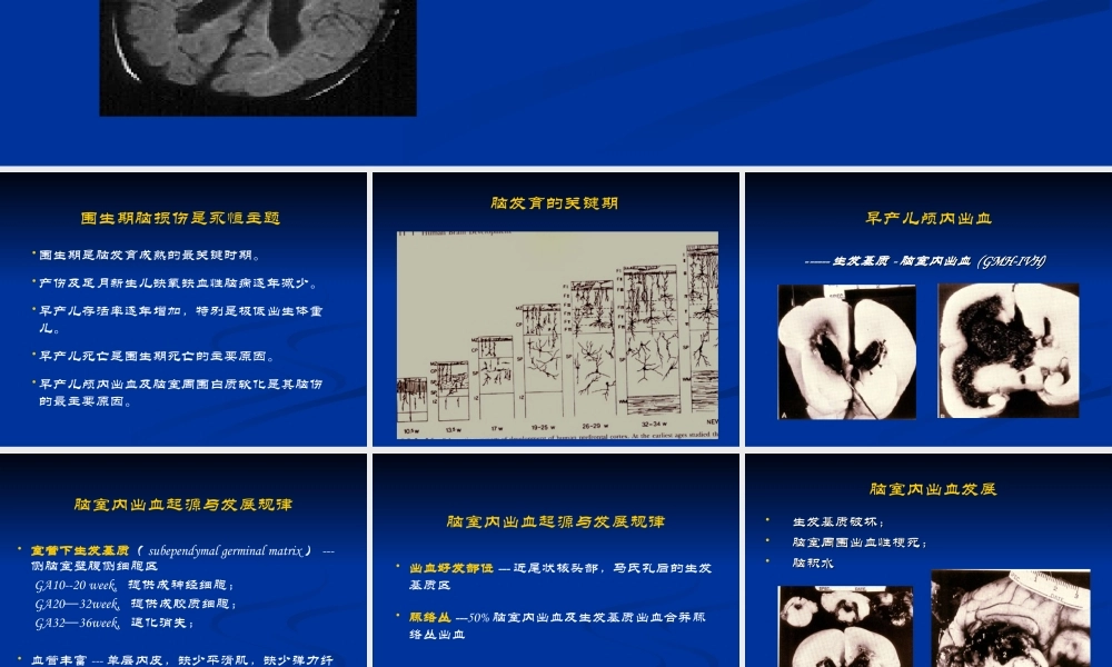 早产儿颅内出血及脑室周围白质软化--中国医大盛京医院.ppt