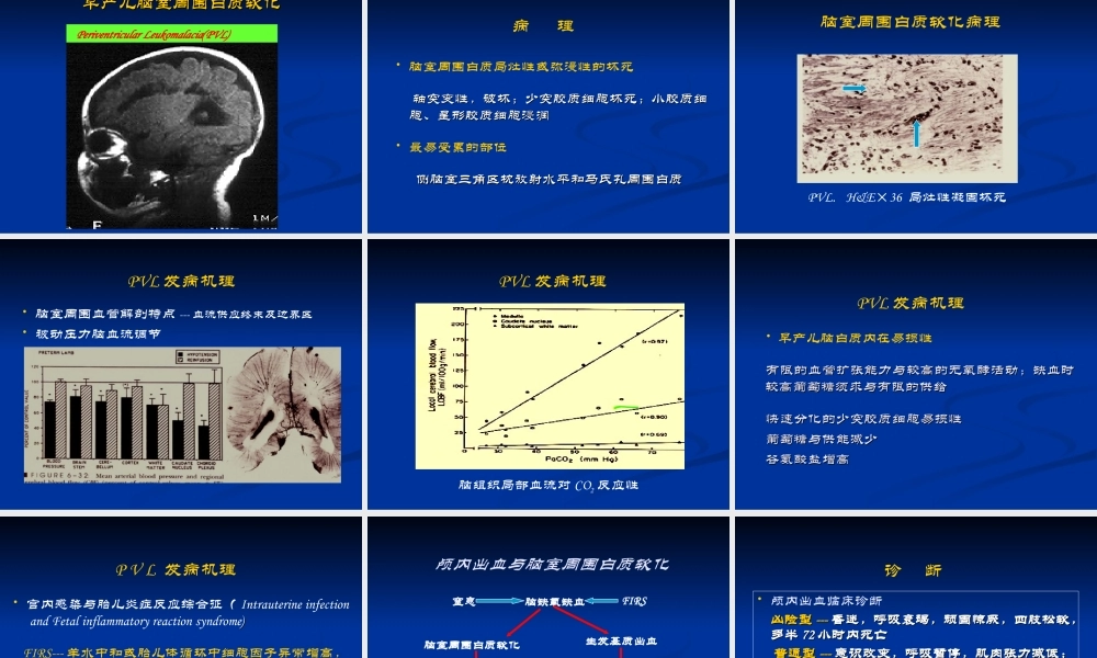 早产儿颅内出血及脑室周围白质软化--中国医大盛京医院.ppt