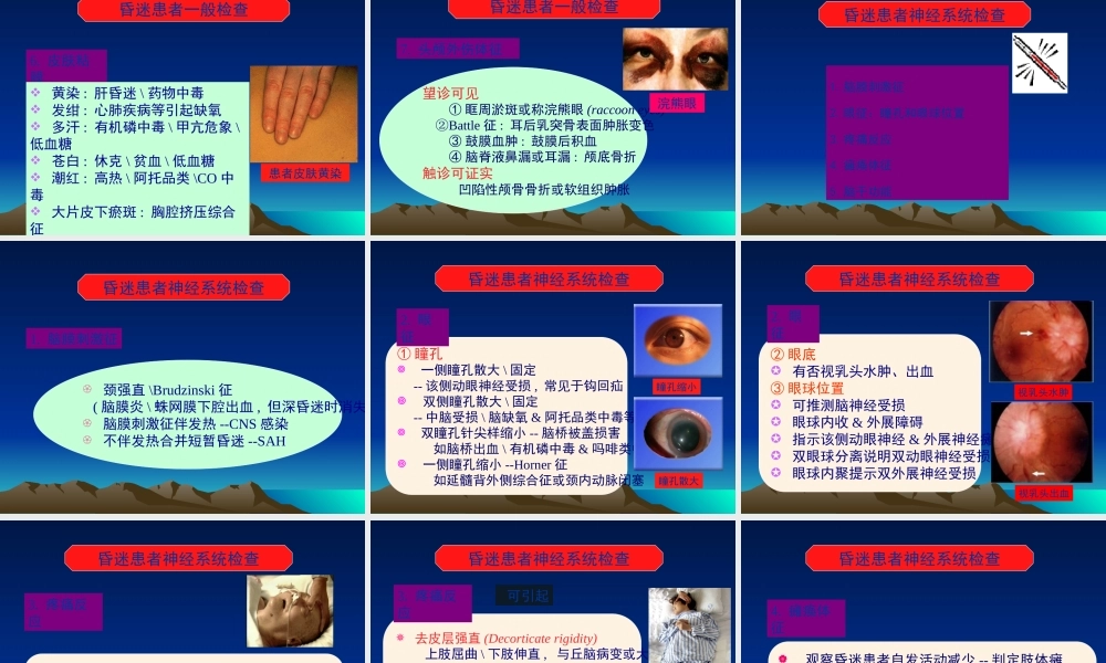 昏迷病人的神经系统检查(精).ppt