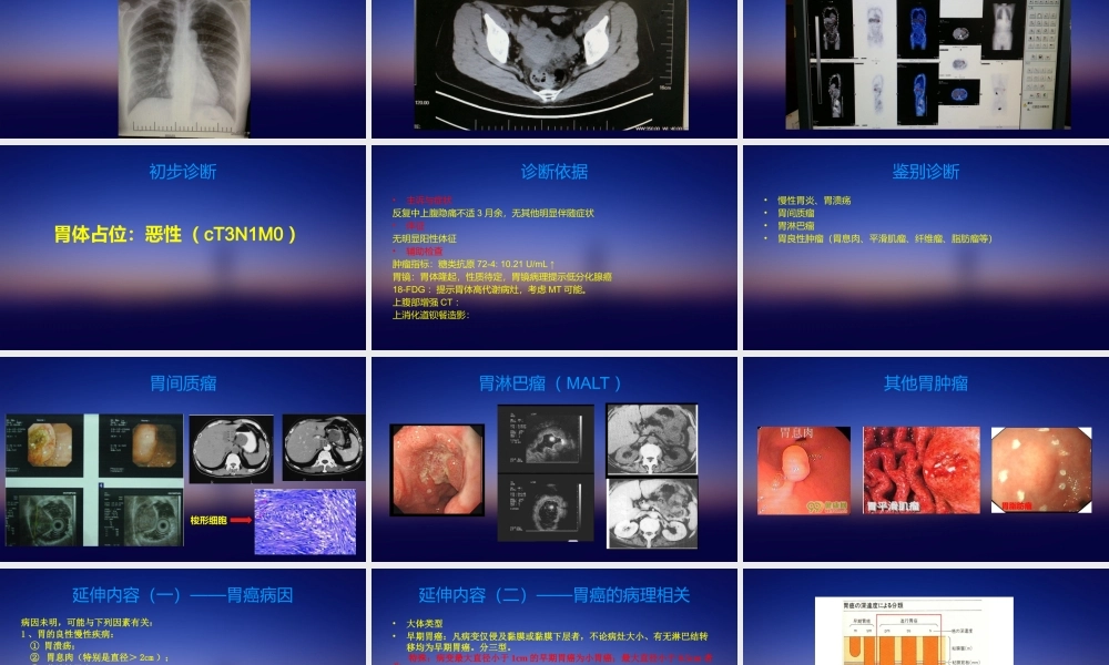 普外科教学查房.pptx