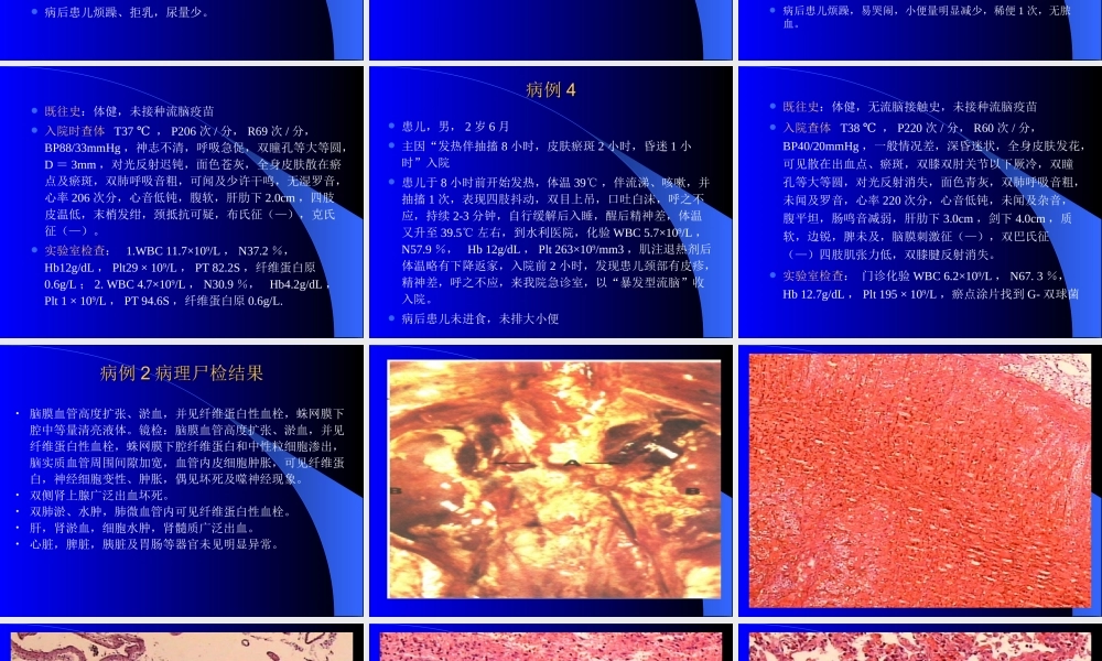 暴发性流行性脑脊髓膜炎.ppt