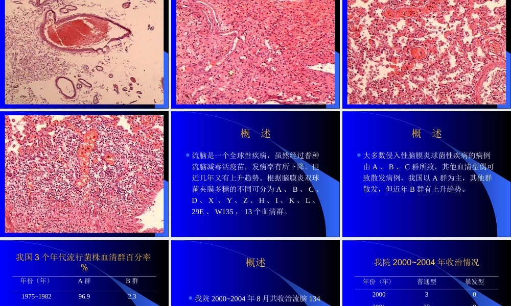 暴发性流行性脑脊髓膜炎.ppt