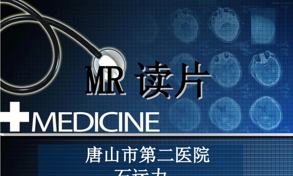 桥小脑角区占位.ppt