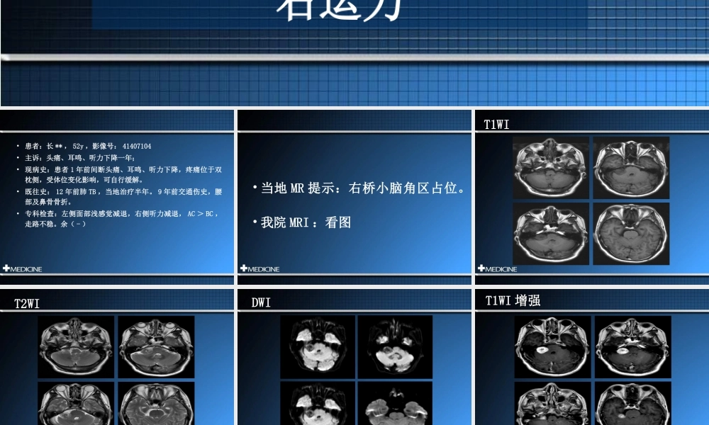 桥小脑角区占位.ppt