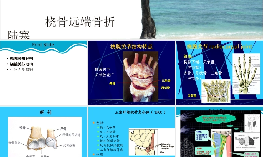 桡骨远端骨折概论.ppt