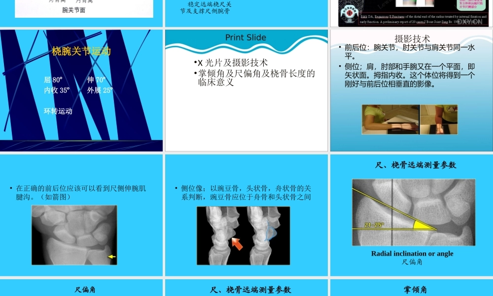 桡骨远端骨折概论.ppt