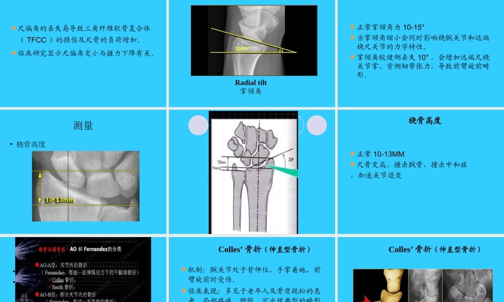 桡骨远端骨折概论.ppt