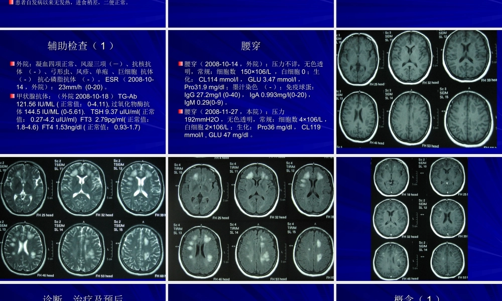 桥本氏脑病-经典幻灯.ppt