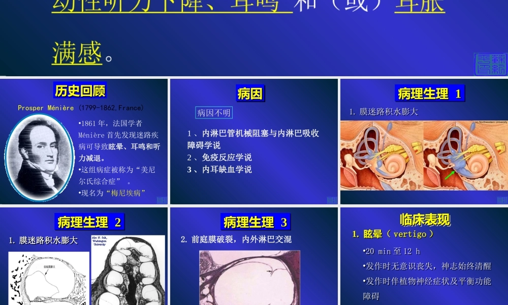 梅尼埃病诊疗指南PPT版.ppt
