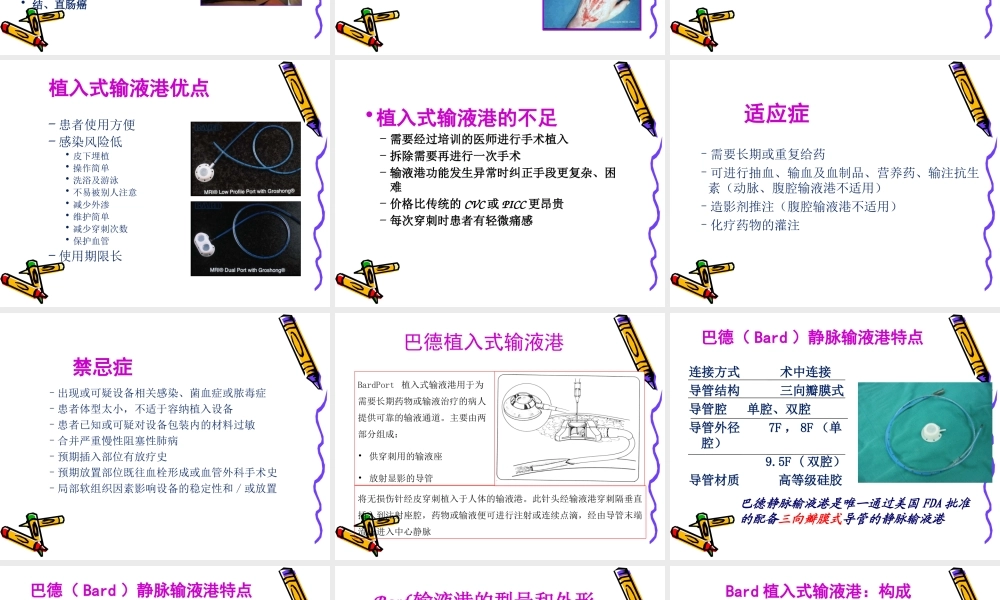 植入式静脉输液港-PORT.ppt